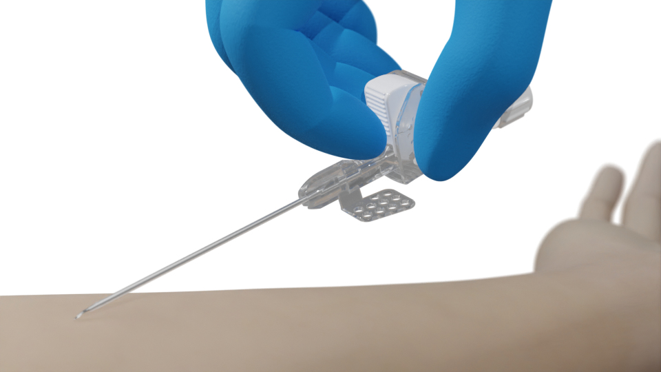 Ebnet Medical - Ebnet PIVC for simple and safe intravenous access
