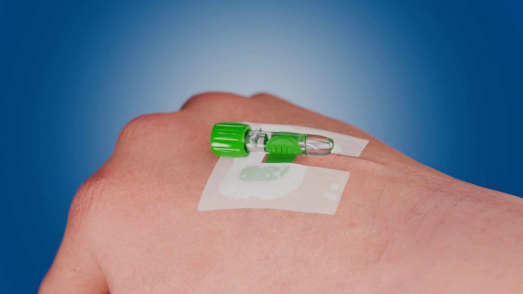 Ebnet Medical: Ebnüle® für den Erstpunktionserfolg