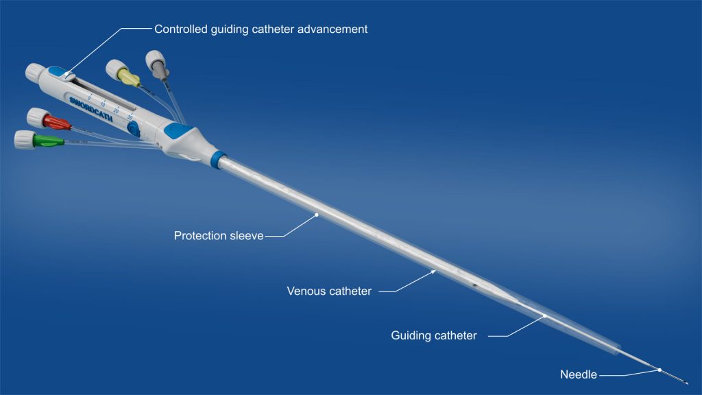 Ebnet Medical: SwordCath®