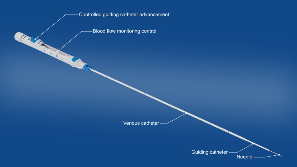 Ebnet Medical: Midline Catheter